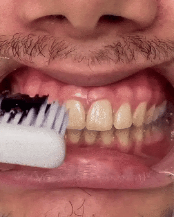 Mousse correctrice V34