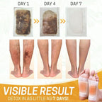 Patchs detox Kinoki