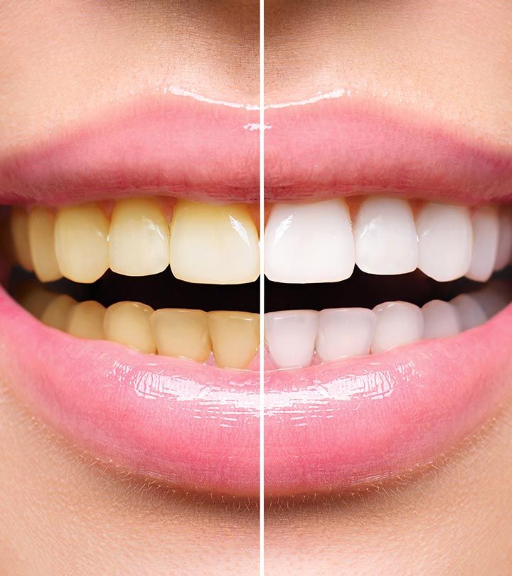Mousse correctrice V34 (01 acheté=01 offert)